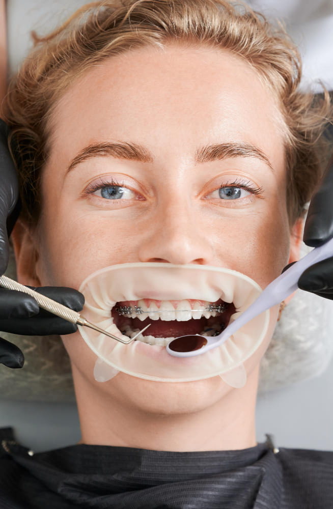 Smile Makeover